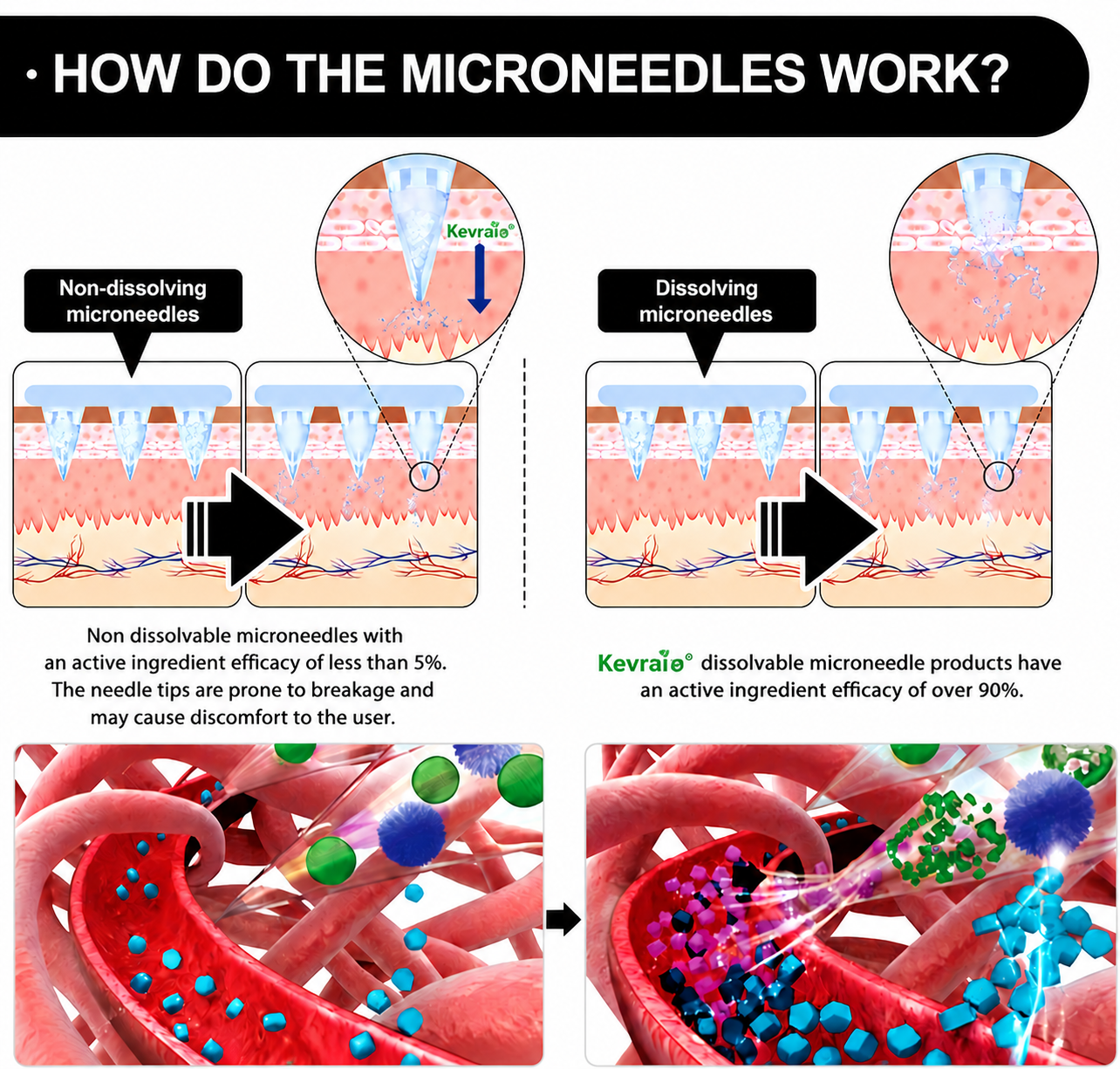 Doctor Recommended 🌟 | Kevrai® Berberine 10-in-1 Nano Microneedle Patch | ✅