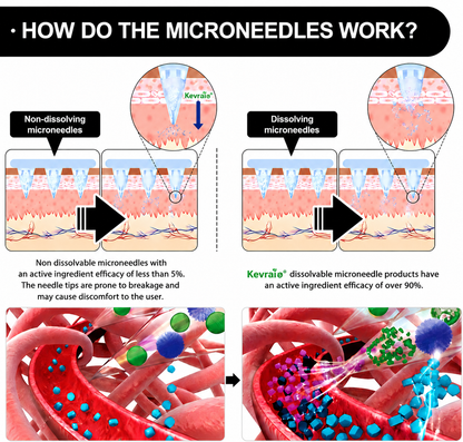 Doctor Recommended 🌟 | Kevrai® Berberine 10-in-1 Nano Microneedle Patch | ✅