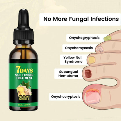 Ginger Nail Rescue Oil | Restore Your Nail Health