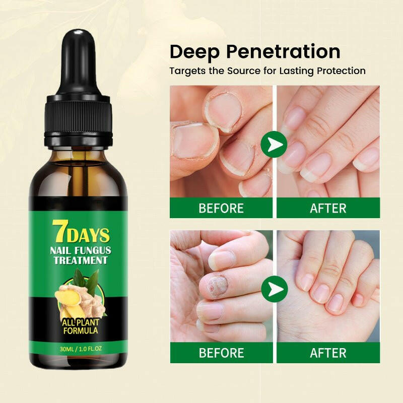 Ginger Nail Rescue Oil | Restore Your Nail Health